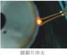 Equipamento de fusão por indução de ultraalta frequência de 1-2 MHz